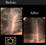 Amazing Hair Saviour - Canada & US Shipping Available or LOCAL pick up!