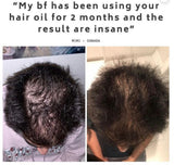 Amazing Hair Saviour - Canada & US Shipping Available or LOCAL pick up!