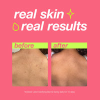 DERMALOGICA - CLEAR START - Clarifying Bacne Spray
