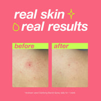 DERMALOGICA - CLEAR START - Clarifying Bacne Spray