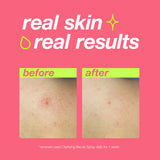 DERMALOGICA - CLEAR START - Clarifying Bacne Spray