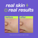 DERMALOGICA - CLEAR START - Post Spot Fix