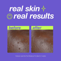 DERMALOGICA - CLEAR START - Post Spot Fix