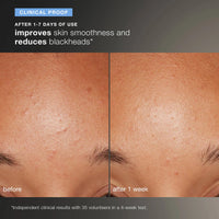 DERMALOGICA - Daily Microfoliant