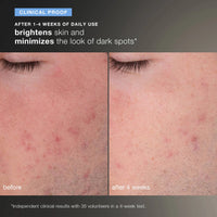 DERMALOGICA - Daily Microfoliant