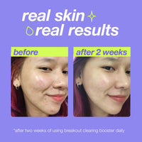 DERMALOGICA - CLEART START - Breakout Clearing Booster