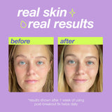 DERMALOGICA - CLEAR START - Post Spot Fix