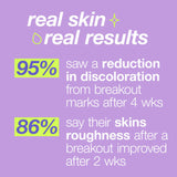 DERMALOGICA - CLEAR START - Post Spot Fix