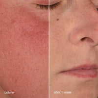 DERMALOGICA- ULTRACALMING - Stabilizing Repair Cream