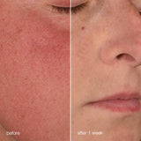 DERMALOGICA- ULTRACALMING - Stabilizing Repair Cream